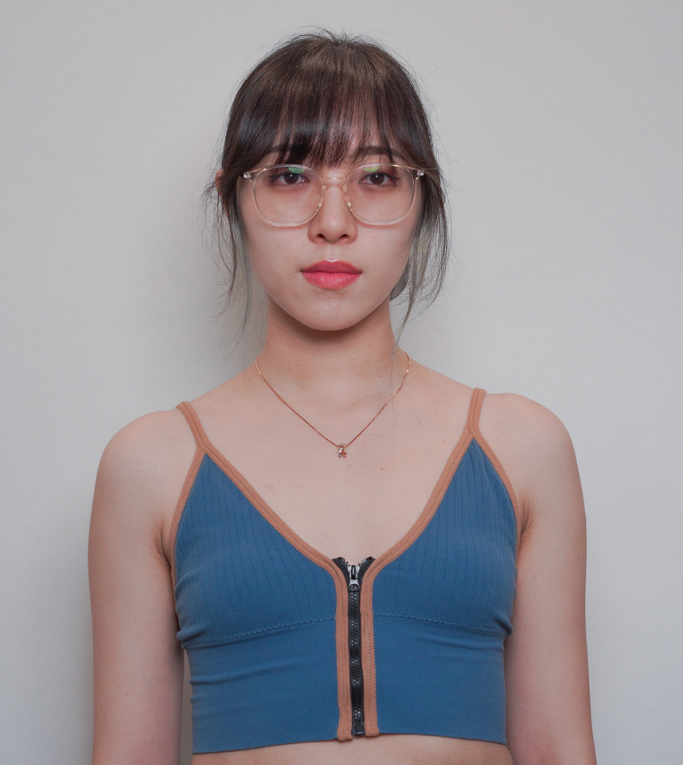 女神波隆乳術前術後對比圖-正面